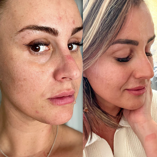 The Importance of a Regular Skincare Routine